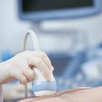 Lekarz przeprowadza badanie USG prostaty u pacjenta